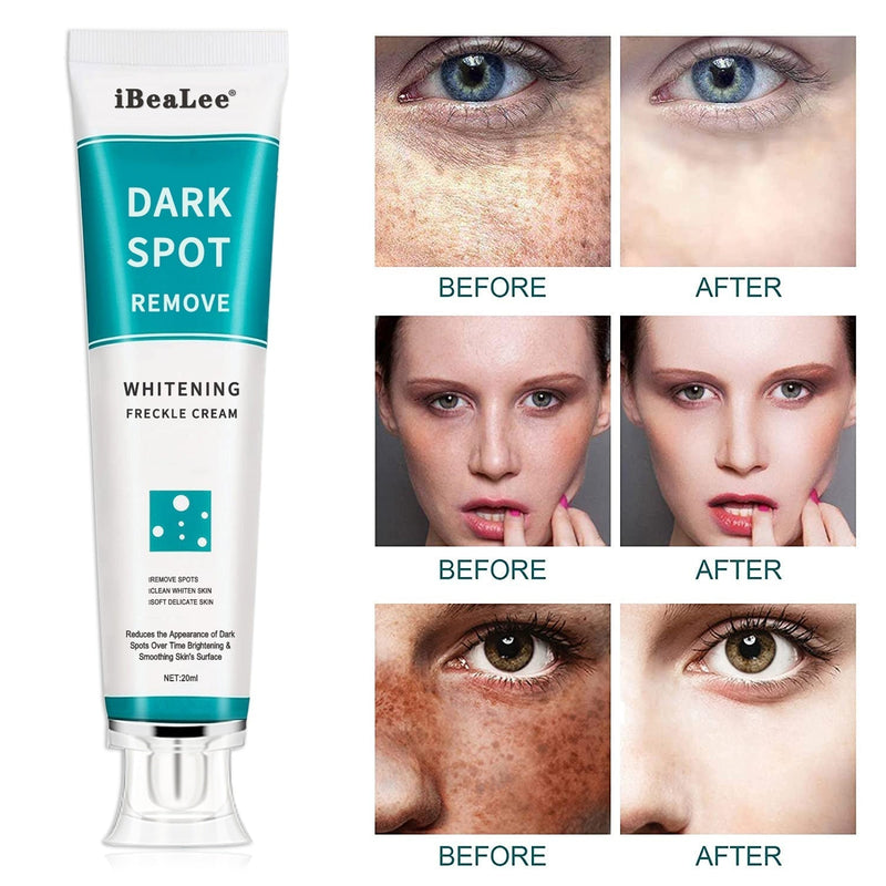 Clareador de Pele Intensivo Dark Spot - Remova as Manchas no seu Corpo Beleza e Cuidado Pessoal Wons Store 