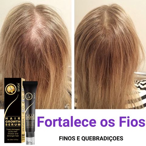 HairMax Pró© | Diminui Queda 95% Aumenta Crescimento 20x | Pague 1 Leve 2 Wons Store 